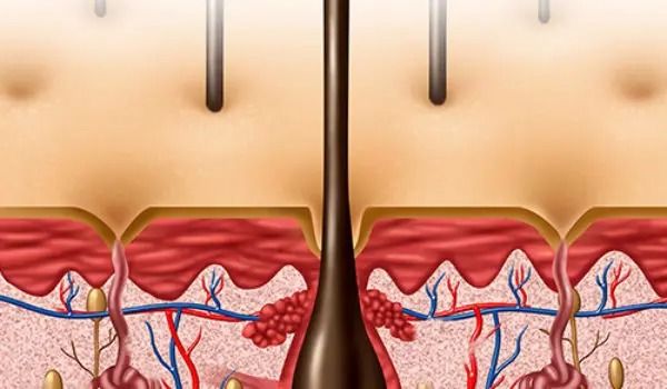 Hair cloning: myth or reality?