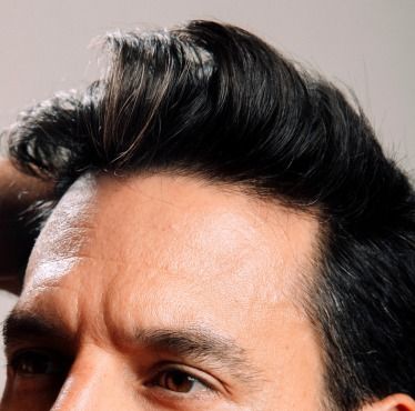 What can be your expectations regarding the FUT graft?