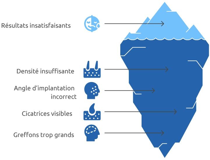 les_erreurs_frequentes_et_solutions_possibles_en_cas_de_greffe_de_barbe_ratee