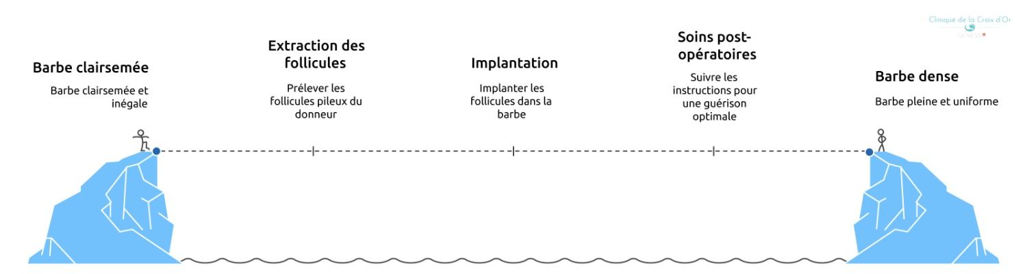 les_erreurs_frequentes_et_solutions_possibles_en_cas_de_greffe_de_barbe_ratee
